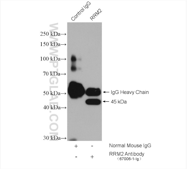 RRM2 Antibody in Immunoprecipitation (IP)