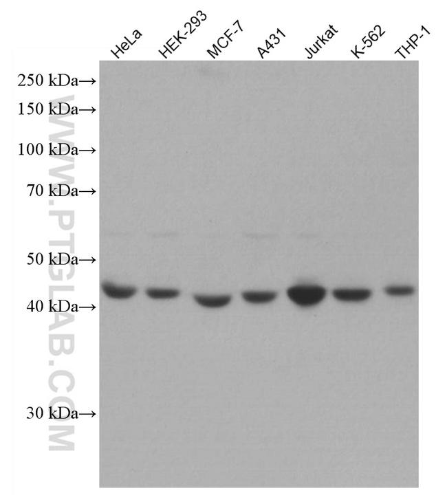 RRM2 Antibody in Western Blot (WB)