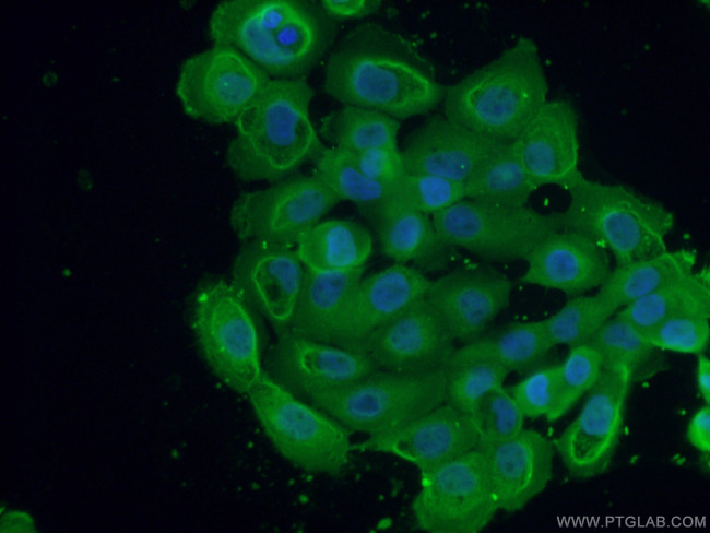 GNAI2 Antibody in Immunocytochemistry (ICC/IF)