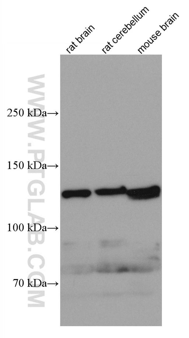 KIF5A Antibody in Western Blot (WB)