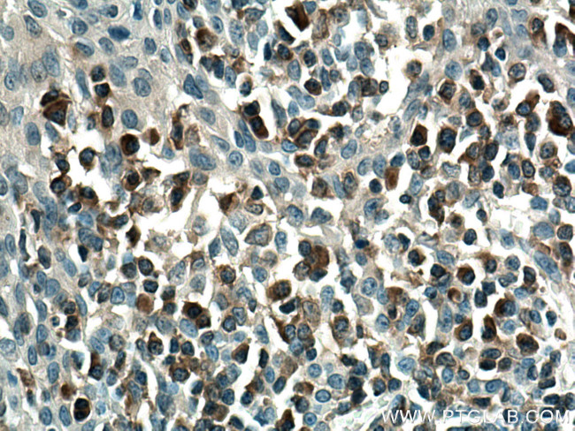 PLCG2 Antibody in Immunohistochemistry (Paraffin) (IHC (P))