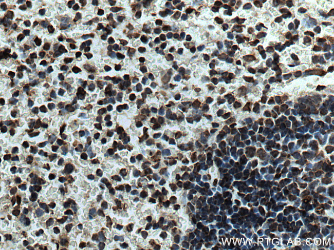 NEIL1 Antibody in Immunohistochemistry (Paraffin) (IHC (P))