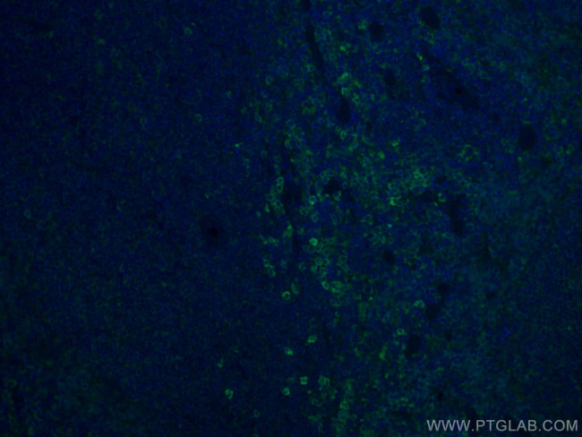 ICAM4 Antibody in Immunohistochemistry (Paraffin) (IHC (P))