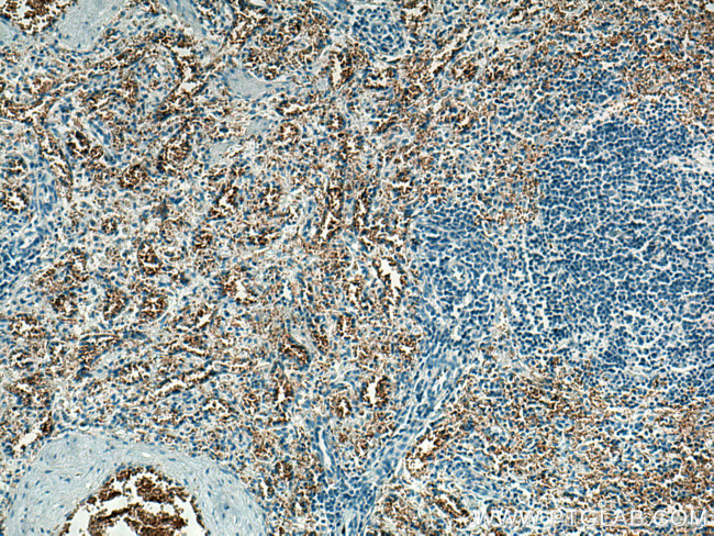 ICAM4 Antibody in Immunohistochemistry (Paraffin) (IHC (P))