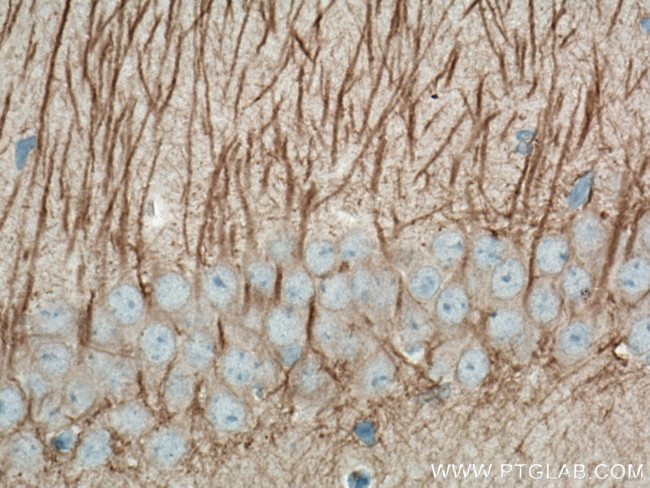 MAP2 Antibody in Immunohistochemistry (Paraffin) (IHC (P))