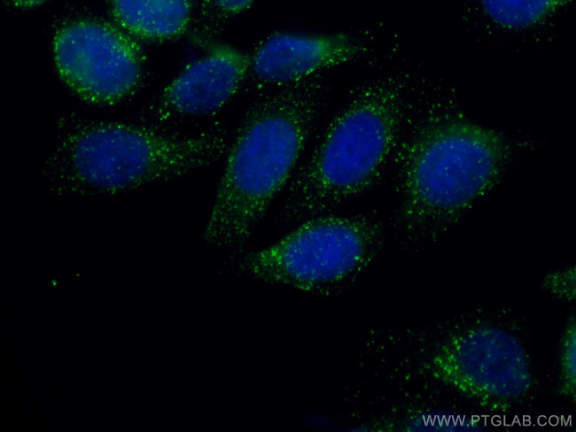 COMMD1 Antibody in Immunocytochemistry (ICC/IF)