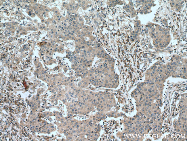 COMMD1 Antibody in Immunohistochemistry (Paraffin) (IHC (P))