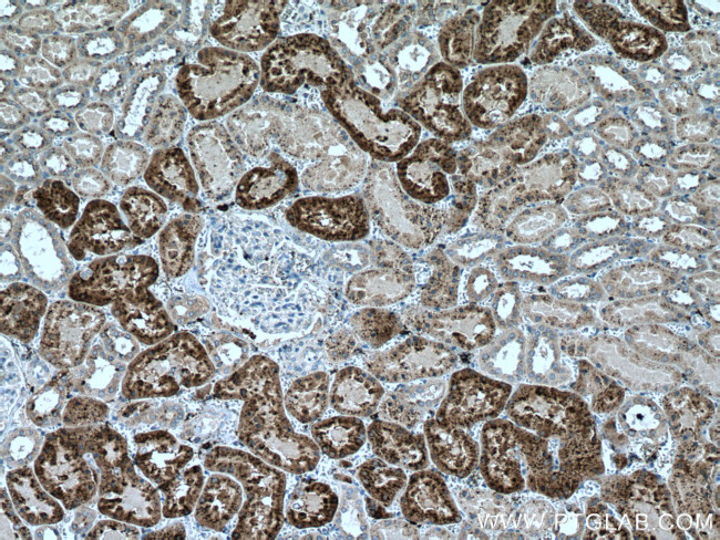 LGMN Antibody in Immunohistochemistry (Paraffin) (IHC (P))