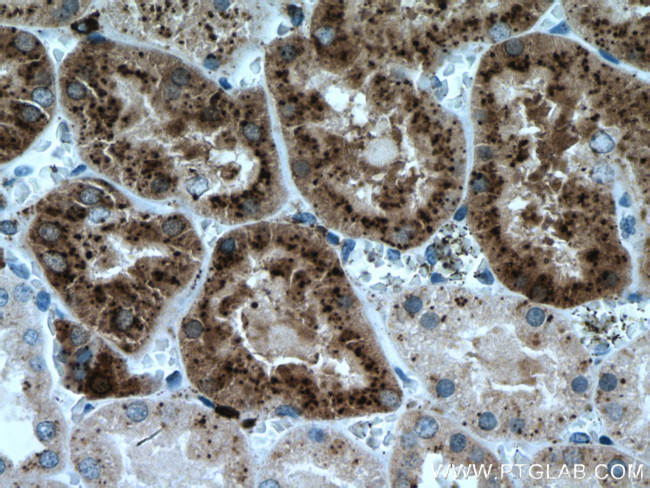 LGMN Antibody in Immunohistochemistry (Paraffin) (IHC (P))