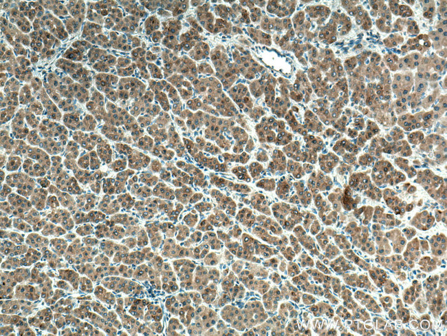 STBD1 Antibody in Immunohistochemistry (Paraffin) (IHC (P))