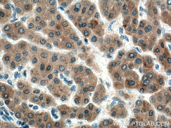 STBD1 Antibody in Immunohistochemistry (Paraffin) (IHC (P))