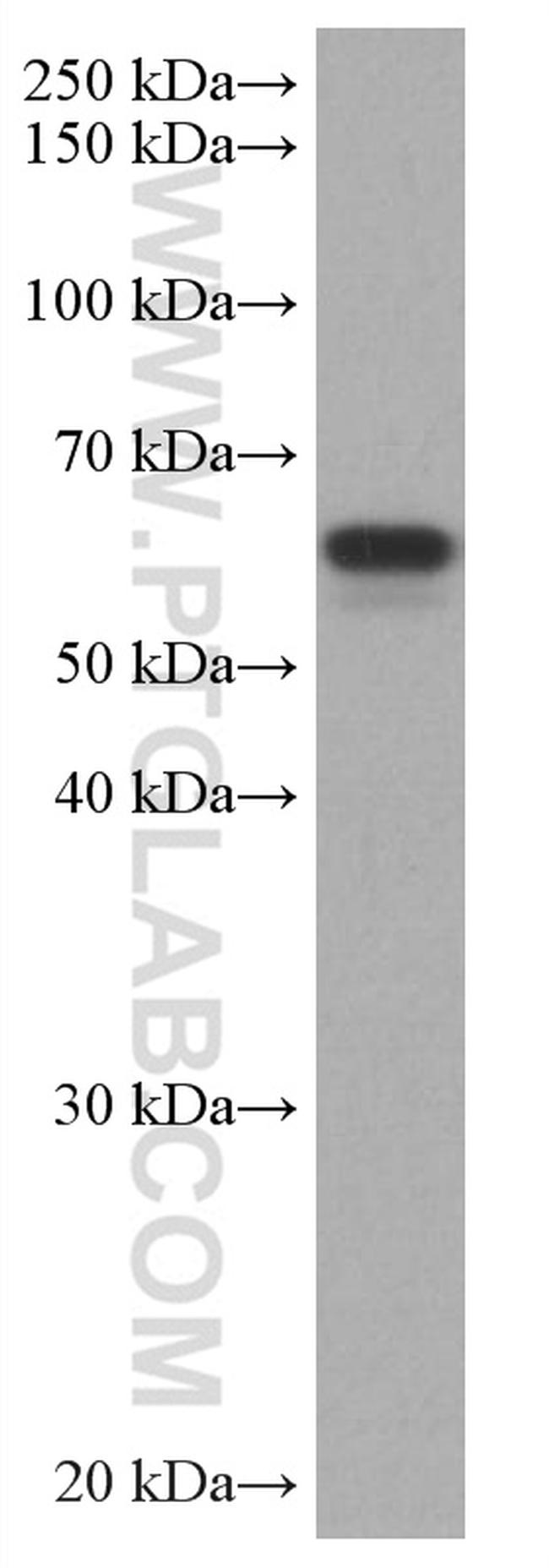 TAB1 Antibody in Western Blot (WB)