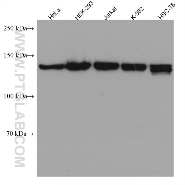 TIMELESS Antibody in Western Blot (WB)