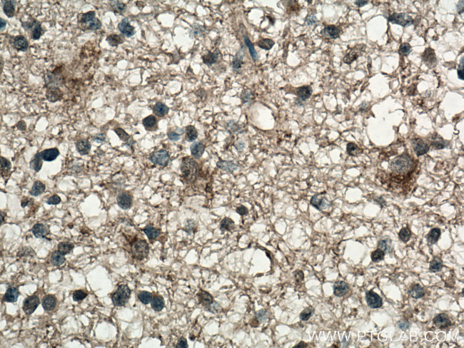 Frizzled 9 Antibody in Immunohistochemistry (Paraffin) (IHC (P))