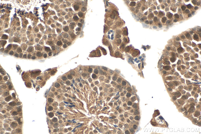 RAD51 Antibody in Immunohistochemistry (Paraffin) (IHC (P))