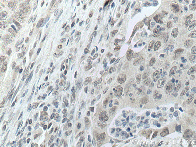 DDX5 Antibody in Immunohistochemistry (Paraffin) (IHC (P))