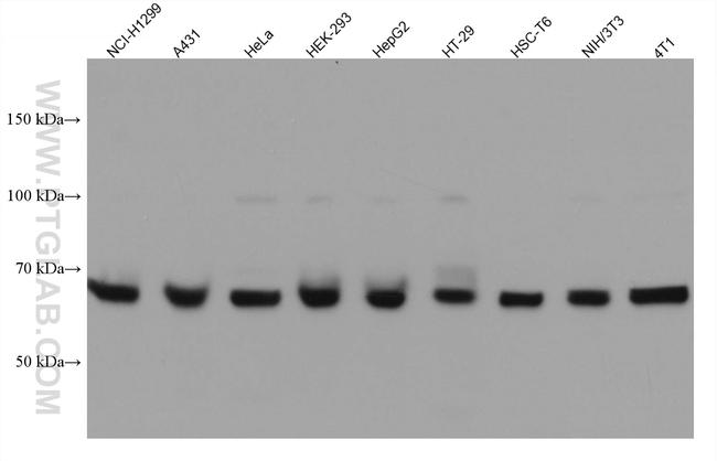 DDX5 Antibody in Western Blot (WB)