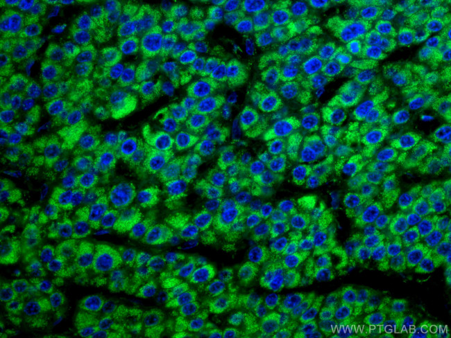 GLUD1 Antibody in Immunohistochemistry (Paraffin) (IHC (P))