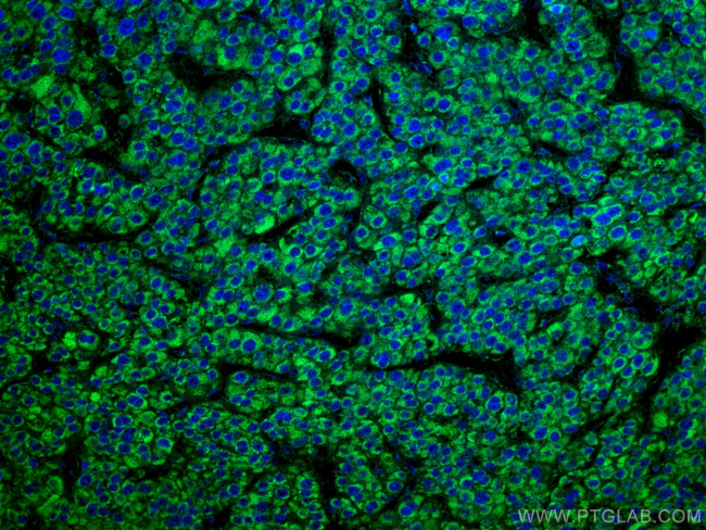 GLUD1 Antibody in Immunohistochemistry (Paraffin) (IHC (P))