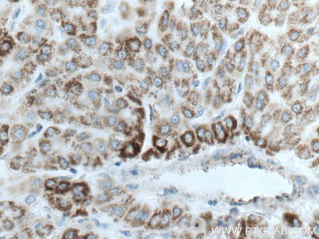 GLUD1 Antibody in Immunohistochemistry (Paraffin) (IHC (P))