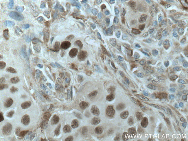 PRC1 Antibody in Immunohistochemistry (Paraffin) (IHC (P))