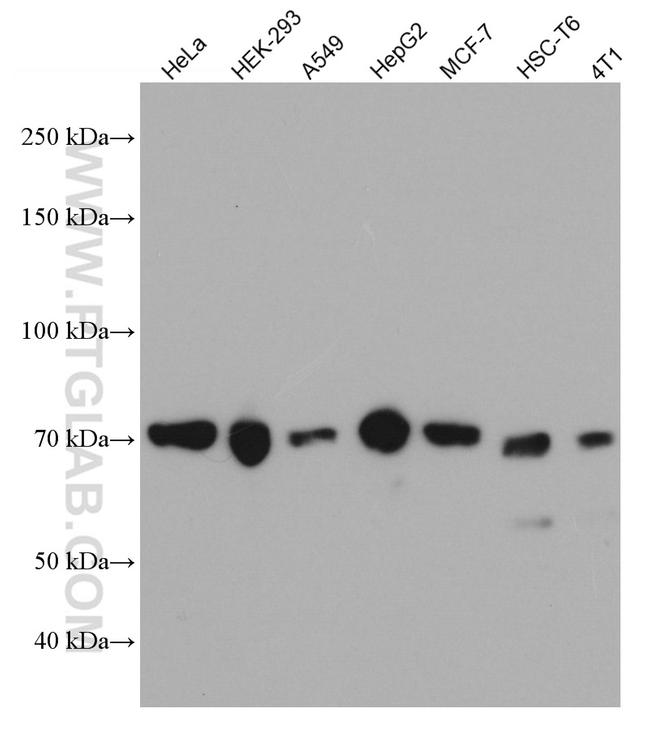 PRC1 Antibody in Western Blot (WB)