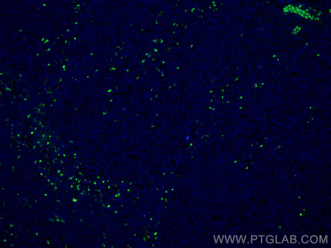 PRTN3 Antibody in Immunohistochemistry (Paraffin) (IHC (P))