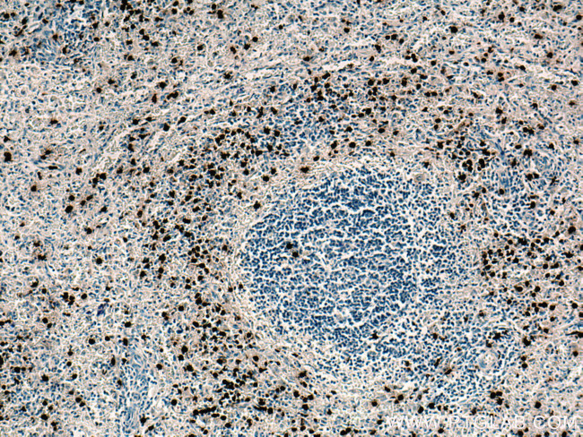 PRTN3 Antibody in Immunohistochemistry (Paraffin) (IHC (P))