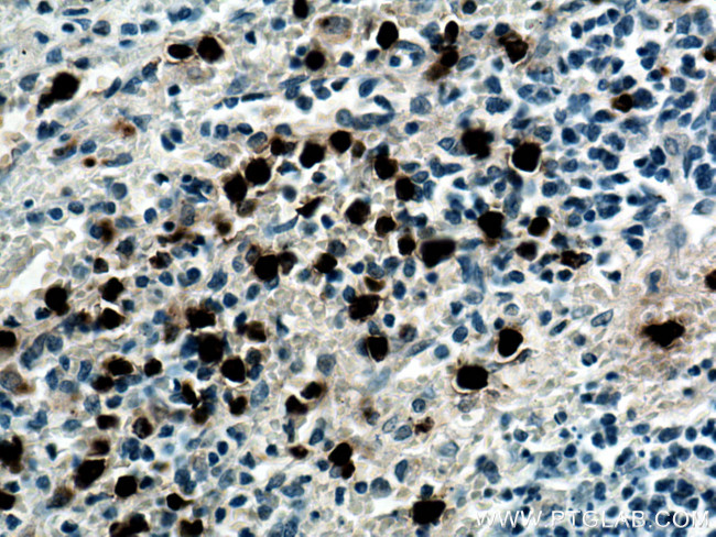 PRTN3 Antibody in Immunohistochemistry (Paraffin) (IHC (P))