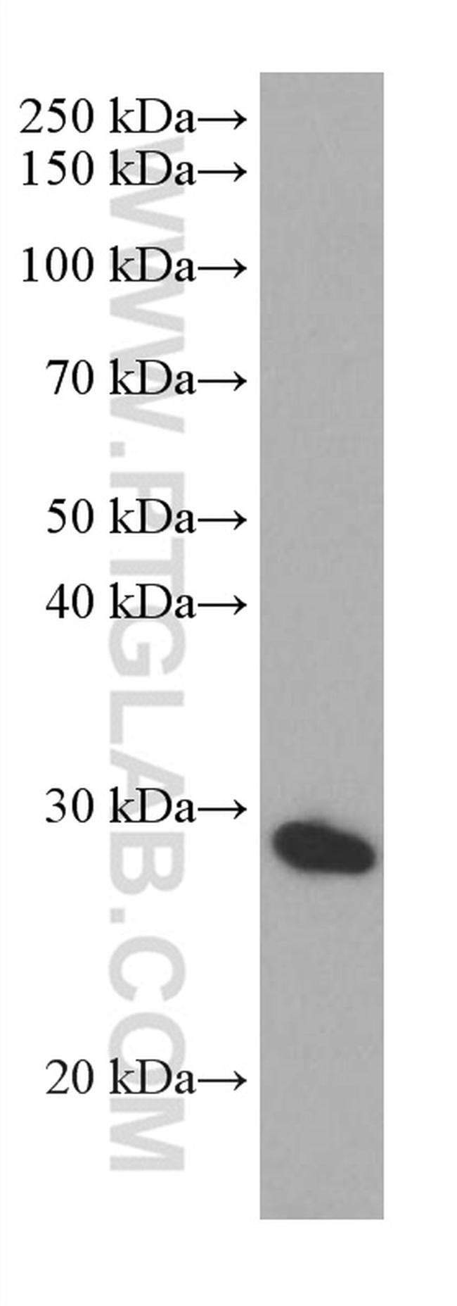 PRTN3 Antibody in Western Blot (WB)