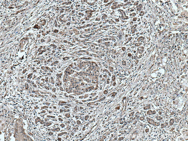 NEU1 Antibody in Immunohistochemistry (Paraffin) (IHC (P))