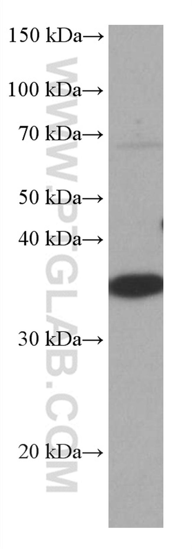 CRK Antibody in Western Blot (WB)