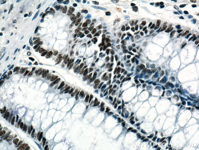 KDM1 Antibody in Immunohistochemistry (Paraffin) (IHC (P))