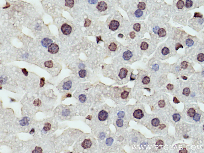 DNASE1L3 Antibody in Immunohistochemistry (Paraffin) (IHC (P))