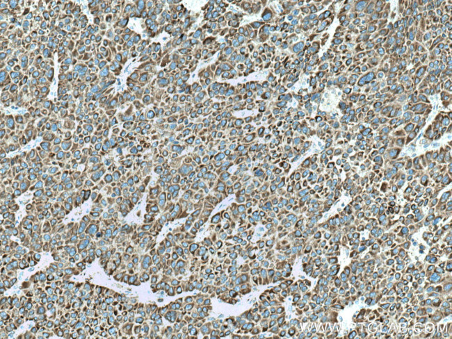 CYP27A1 Antibody in Immunohistochemistry (Paraffin) (IHC (P))