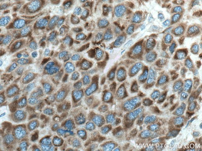 CYP27A1 Antibody in Immunohistochemistry (Paraffin) (IHC (P))