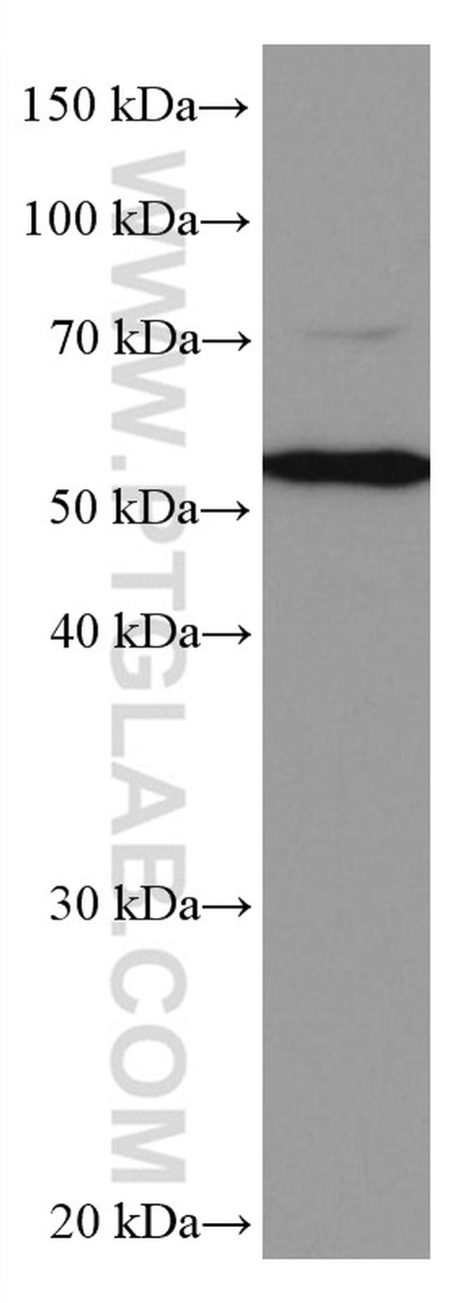 CYP27A1 Antibody in Western Blot (WB)