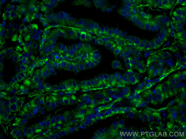 GUK1 Antibody in Immunohistochemistry (Paraffin) (IHC (P))