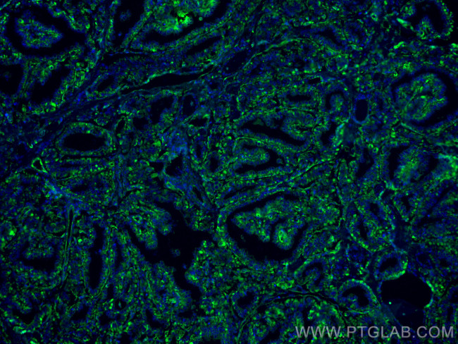 GUK1 Antibody in Immunohistochemistry (Paraffin) (IHC (P))