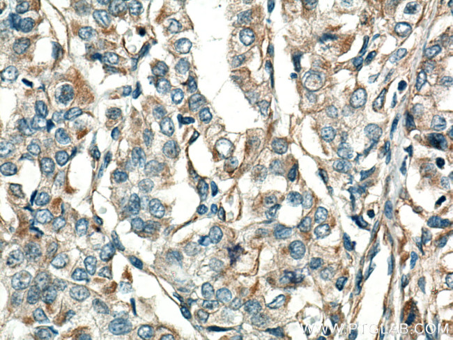 GUK1 Antibody in Immunohistochemistry (Paraffin) (IHC (P))