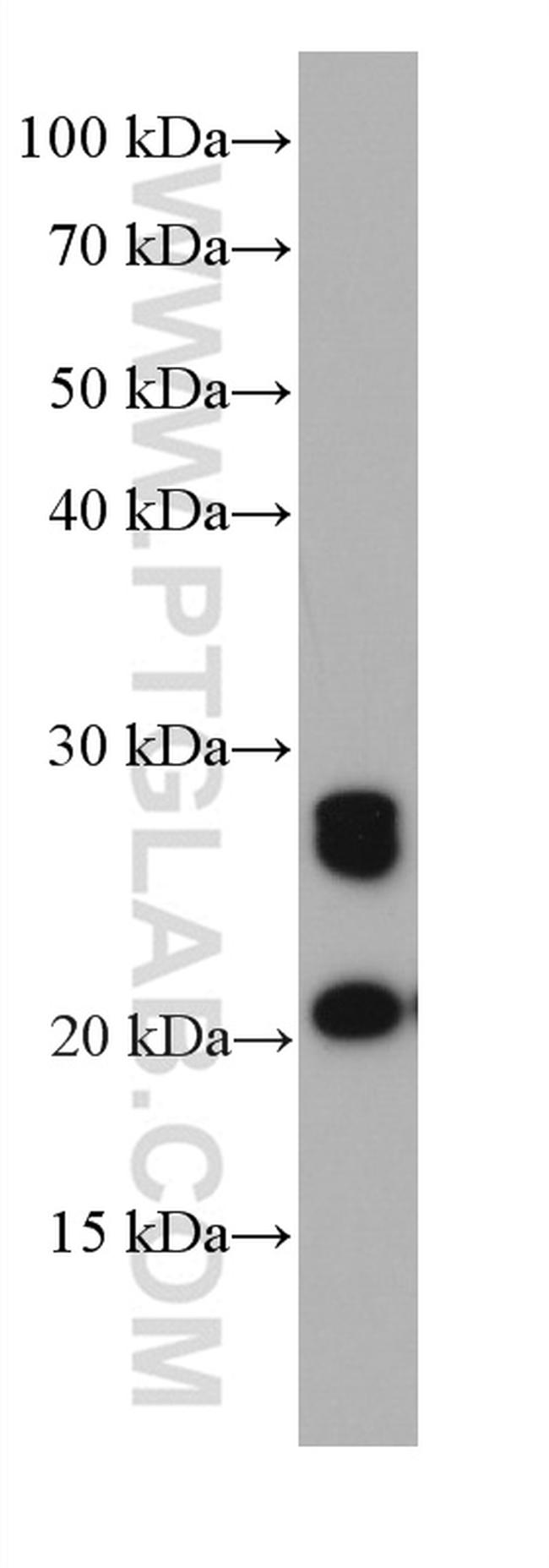 GUK1 Antibody in Western Blot (WB)