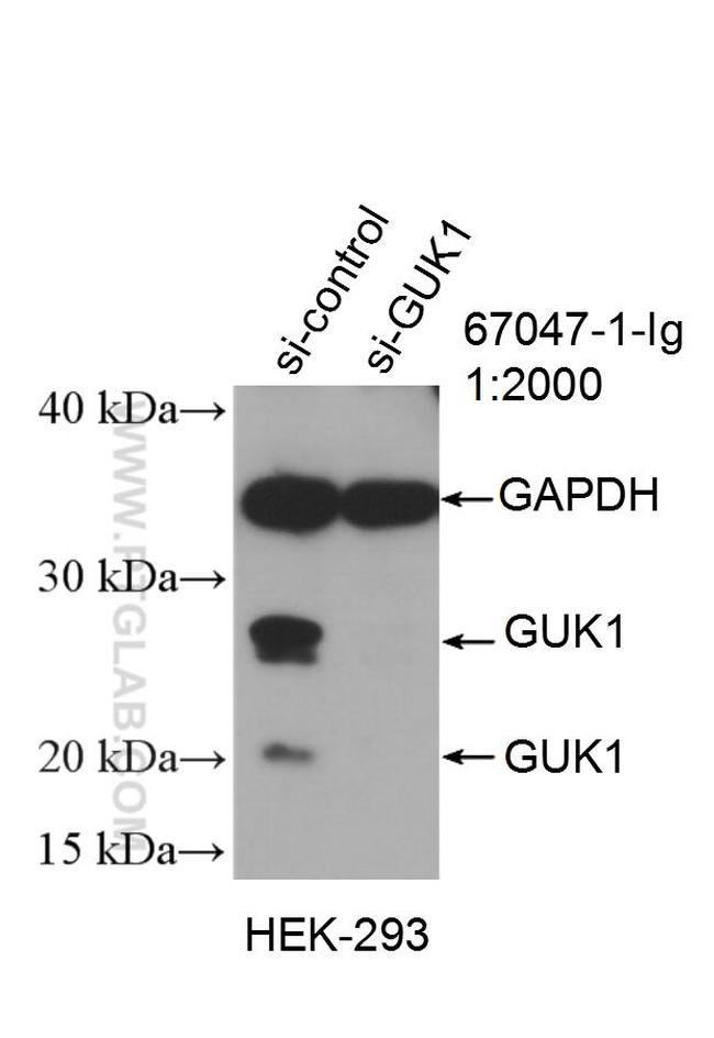 GUK1 Antibody in Western Blot (WB)