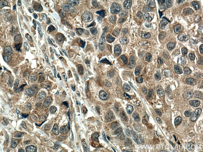 SMAD5 Antibody in Immunohistochemistry (Paraffin) (IHC (P))