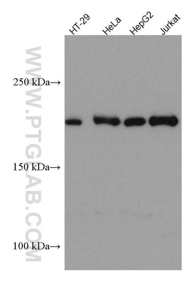 ERCC5 Antibody in Western Blot (WB)