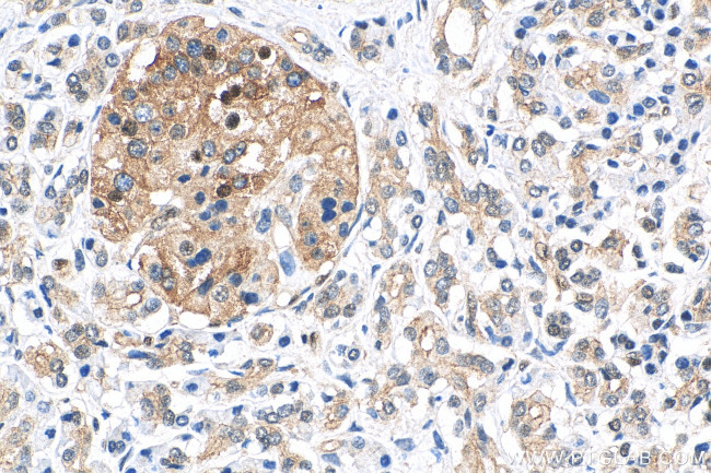 ATX3/ATXN3 Antibody in Immunohistochemistry (Paraffin) (IHC (P))