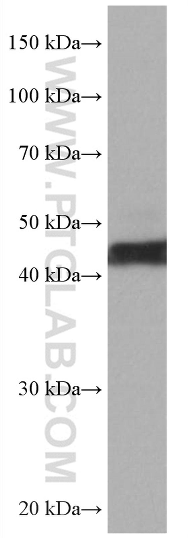 ATX3/ATXN3 Antibody in Western Blot (WB)