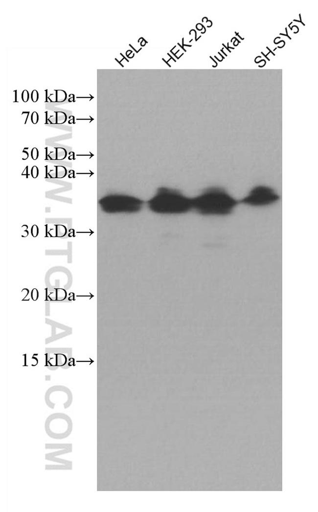 ATF5 Antibody in Western Blot (WB)