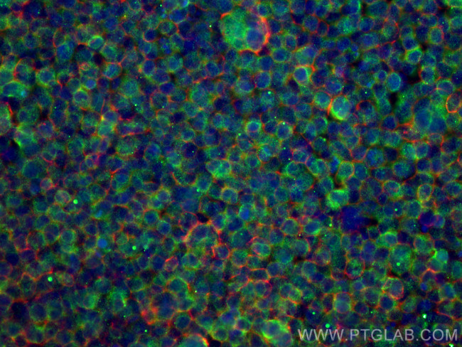 ADRBK1 Antibody in Immunocytochemistry (ICC/IF)