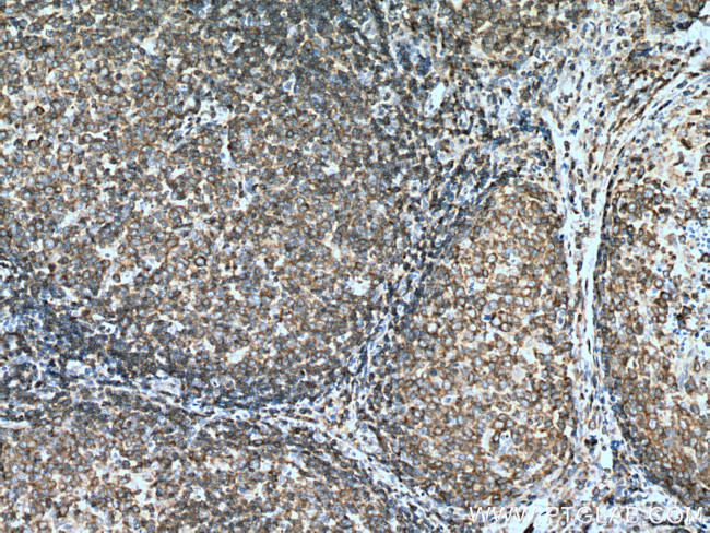 ADRBK1 Antibody in Immunohistochemistry (Paraffin) (IHC (P))