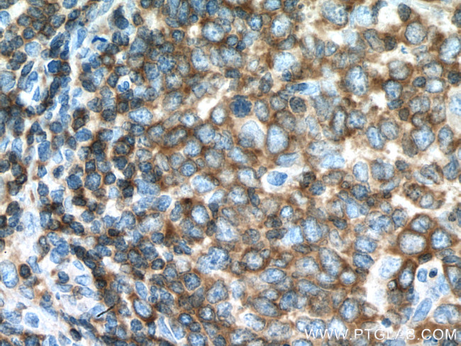 ADRBK1 Antibody in Immunohistochemistry (Paraffin) (IHC (P))